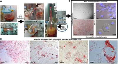 Leptin and TGF-β1 Downregulate PREP1 Expression in Human Adipose-Derived Mesenchymal Stem Cells and Mature Adipocytes